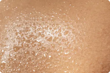 Understanding Your Skin Barrier